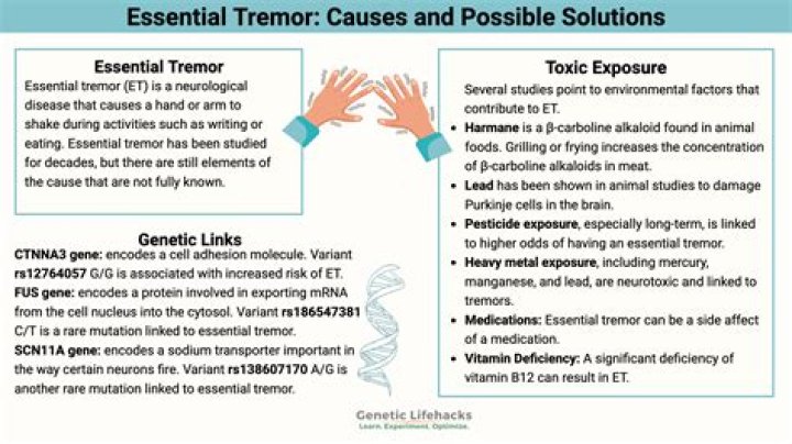 Can you drive with essential tremor?