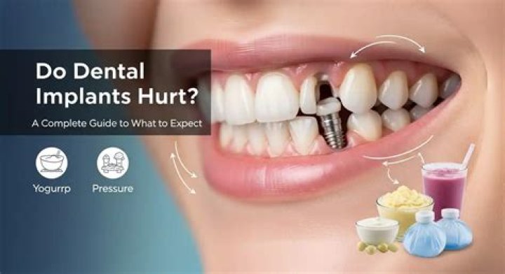 Do dental implants hurt long-term?