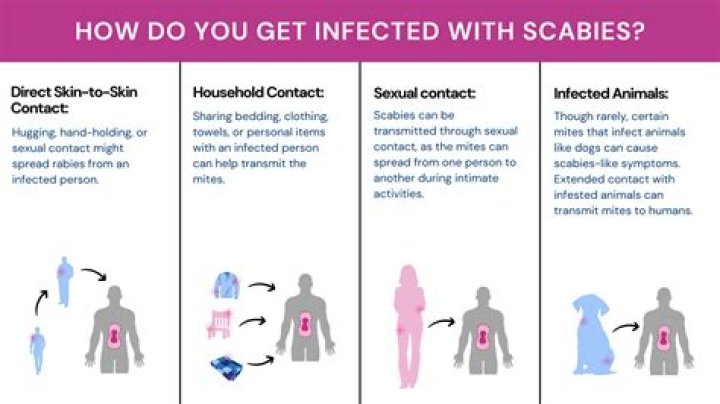 Do scabies look like black specks?