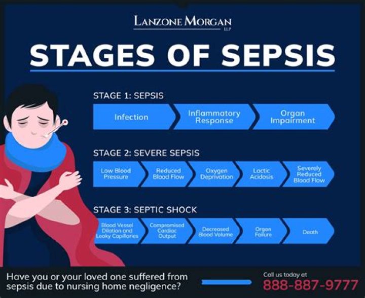 Does sepsis shorten your life?