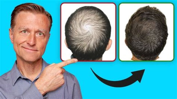 How can I regain my hair loss naturally?