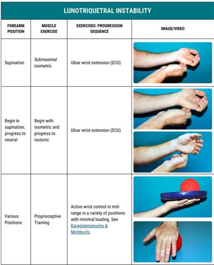 How can I tell if I broke my wrist or just sprained it?