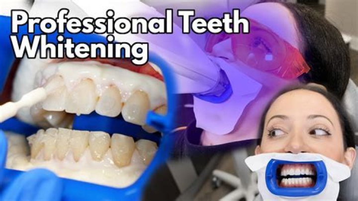How do dentist whiten teeth?