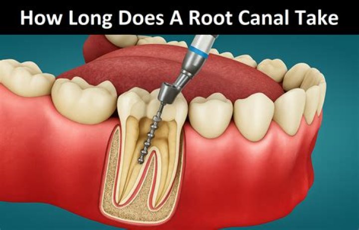 How long does root rot take to happen?