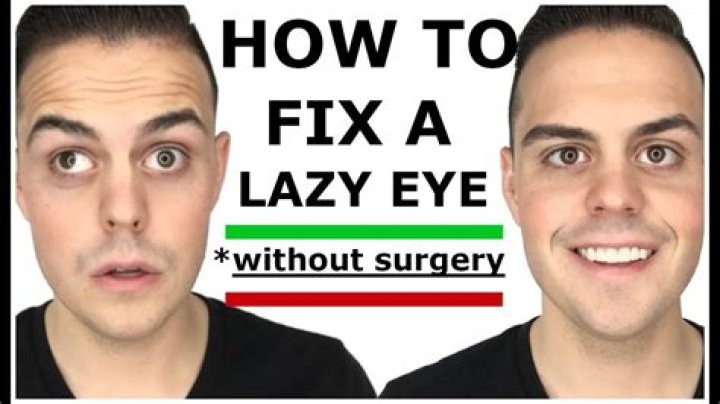 How successful is lazy eye surgery?