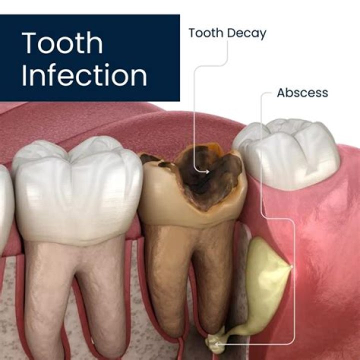 Is knocking a tooth out GBH?