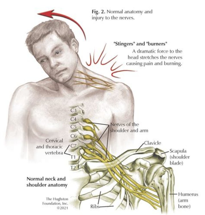 What are symptoms of nerve damage in your neck?