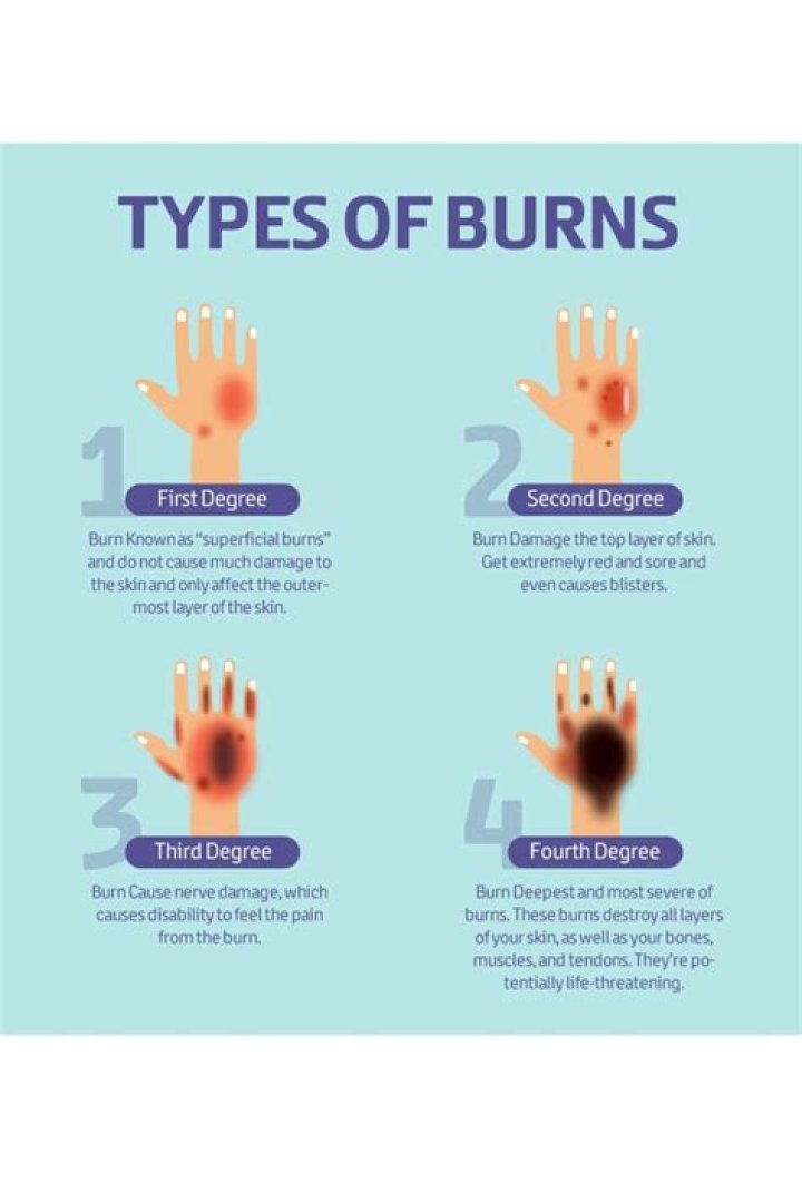 What are the 3 types of burns?
