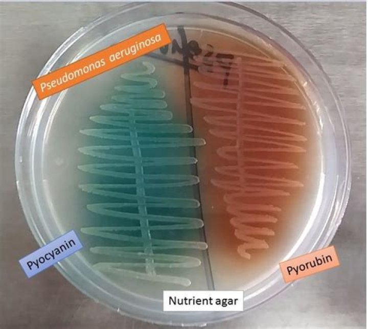 What color is Pseudomonas drainage?