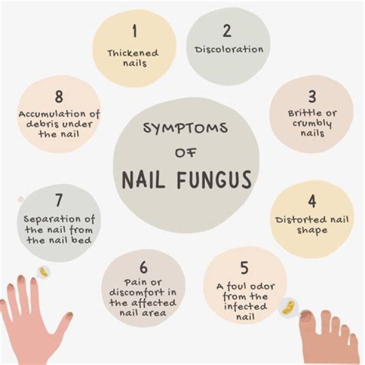 What deficiency causes fungus?