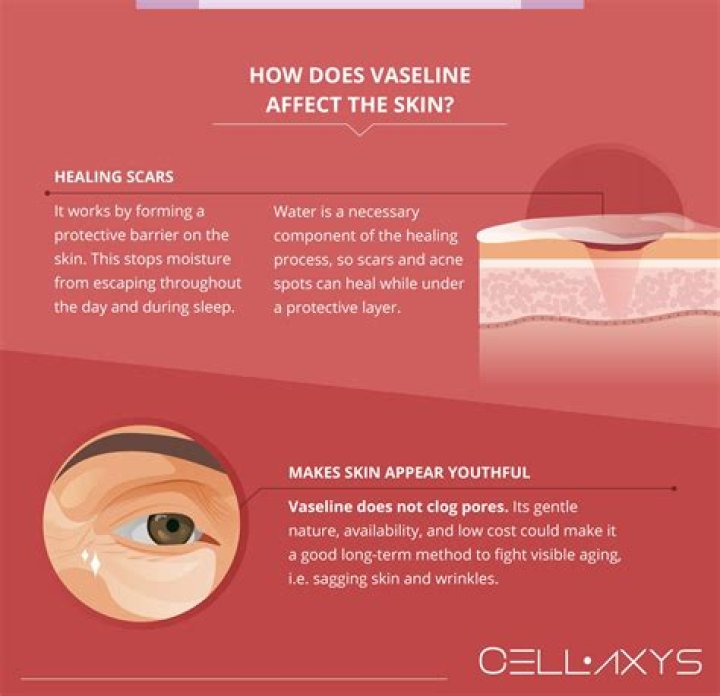 What does Vaseline do for skin?