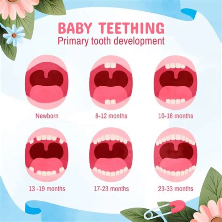 What is white capping teething?