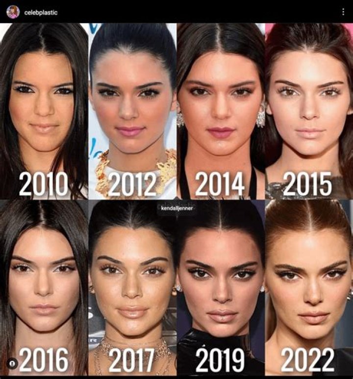 What type of eyes do Kendall Jenner have?