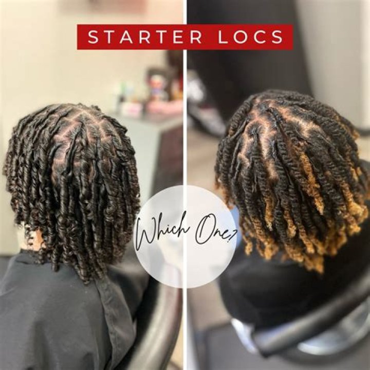 Why do my starter locs itch?