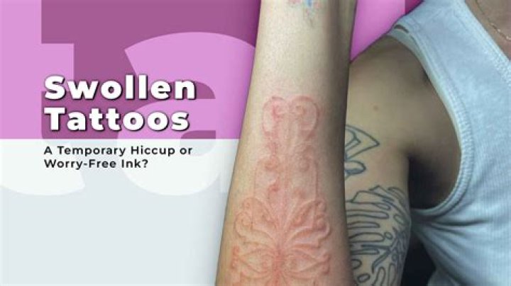 Why do my tattoos swell up?