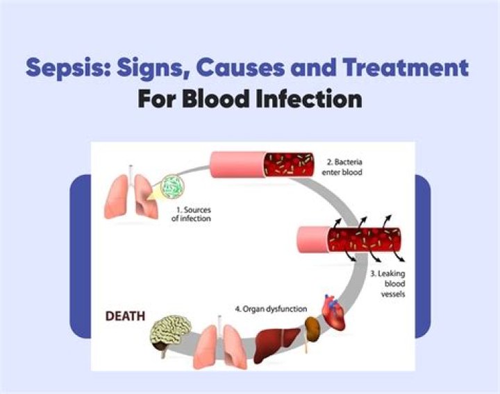 Will antibiotics stop sepsis?
